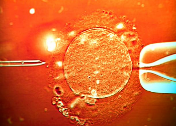 IVF in India