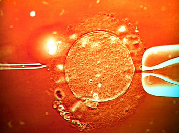 IVF in India