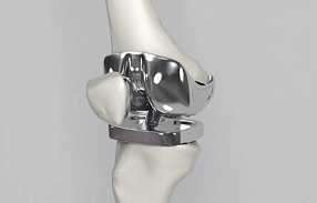 Knee Replacement